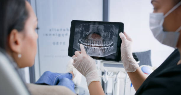 Licensed Tooth Extraction service in Mooresville, NC - Smile Center Dentistry